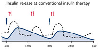 Insulinrelease at conventional insulin therapy:  (© )
